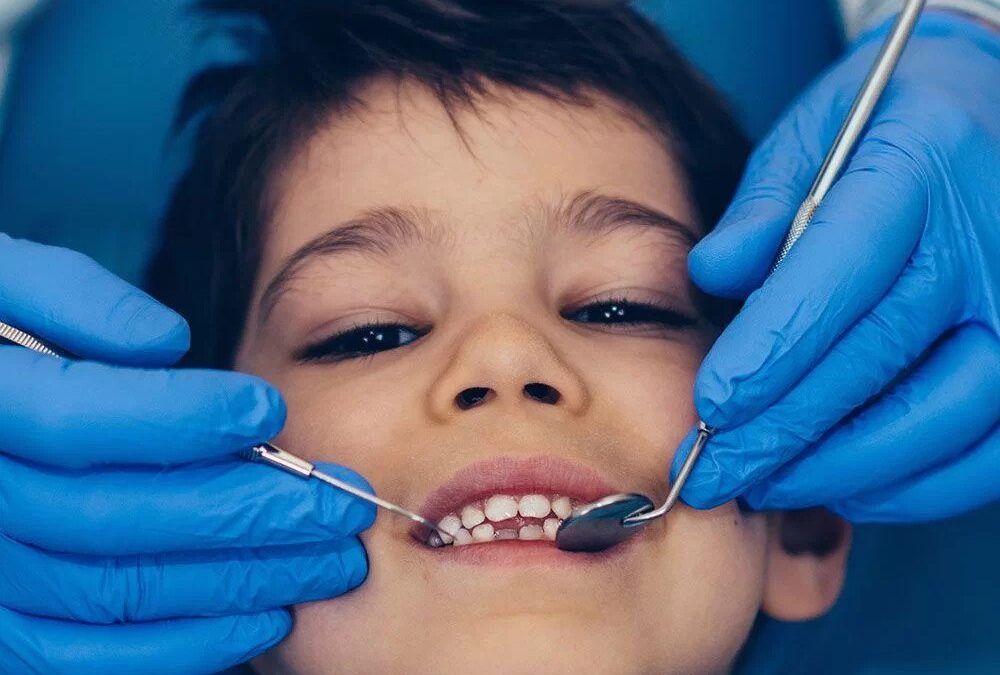 What causes cavities, and why do my children continue to get them?