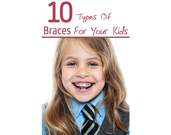 What You Need to Know About Braces for Kids 